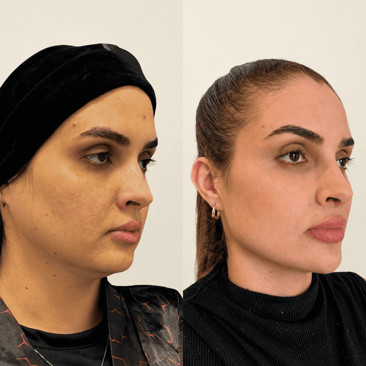 Antes e depois 3