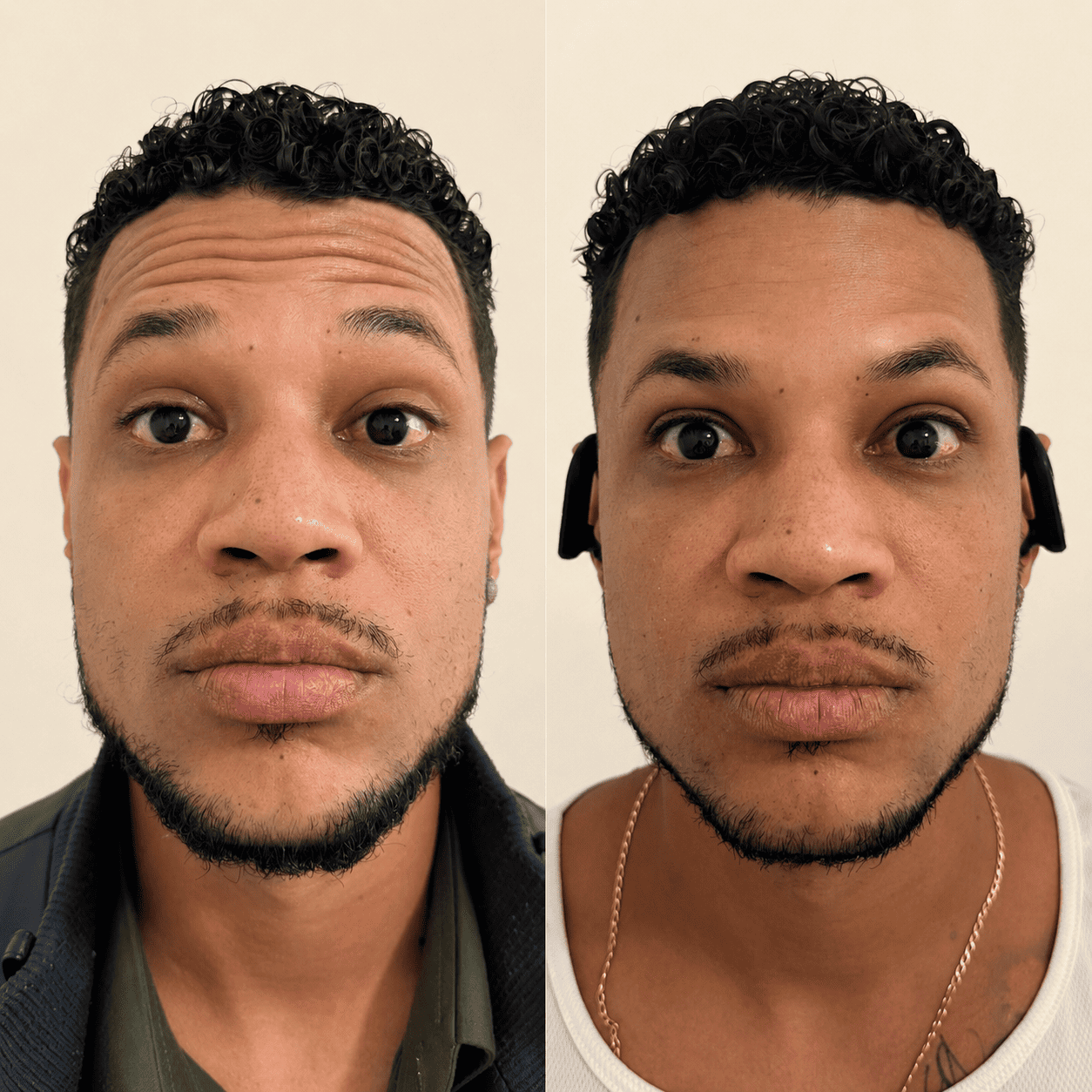 Antes e depois 6