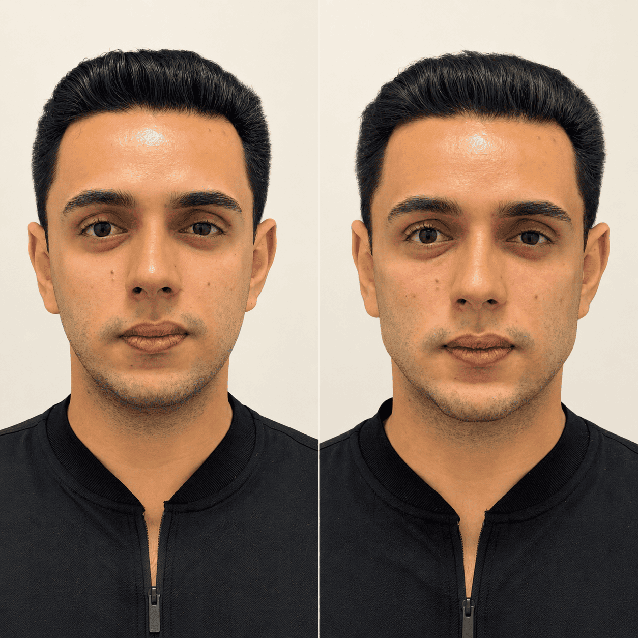 Antes e depois 4