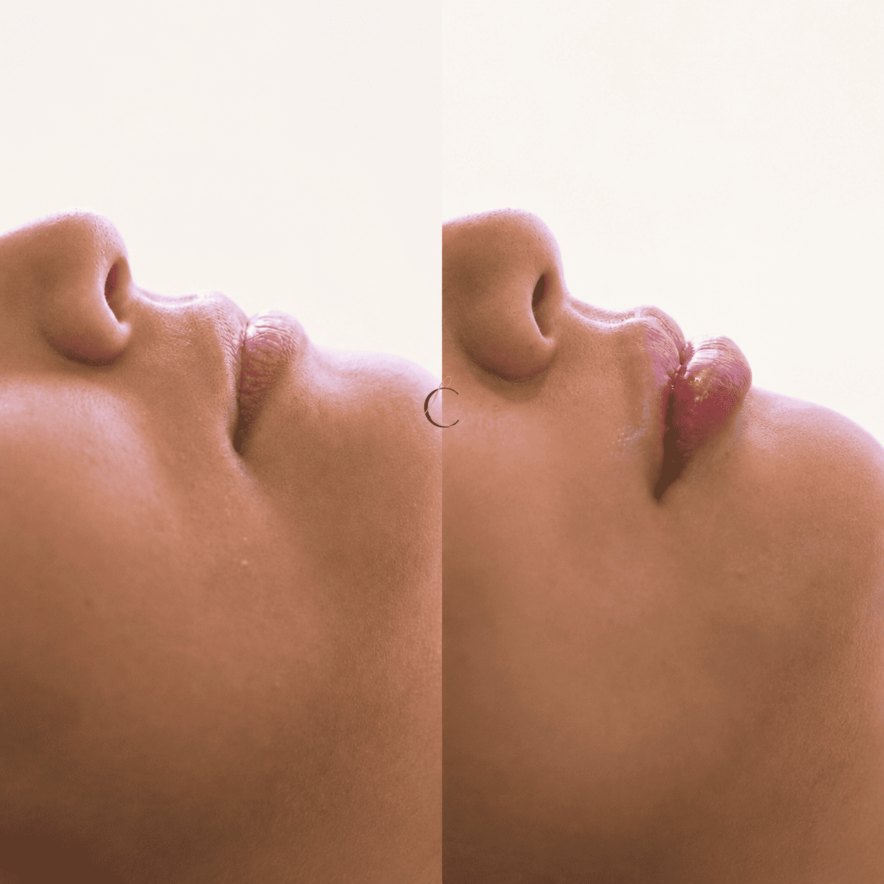 Antes e depois 8